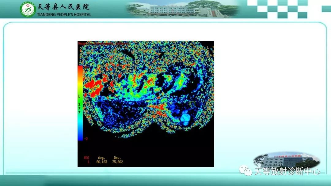 影像PPT - 【病例】乳腺纤维腺瘤1例MR影像-10 影像PPT - 【病例】乳腺纤维腺瘤1例MR影像-10