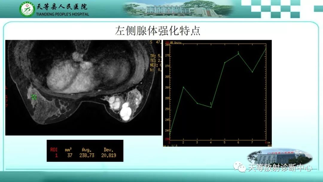 影像PPT - 【病例】乳腺纤维腺瘤1例MR影像-12 影像PPT - 【病例】乳腺纤维腺瘤1例MR影像-12