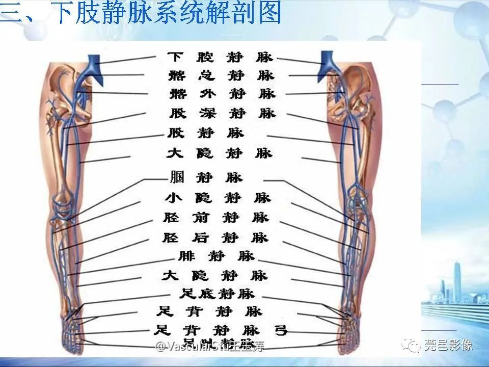 影像PPT - 【PPT】浅谈下肢静脉CTV的应用体会-10