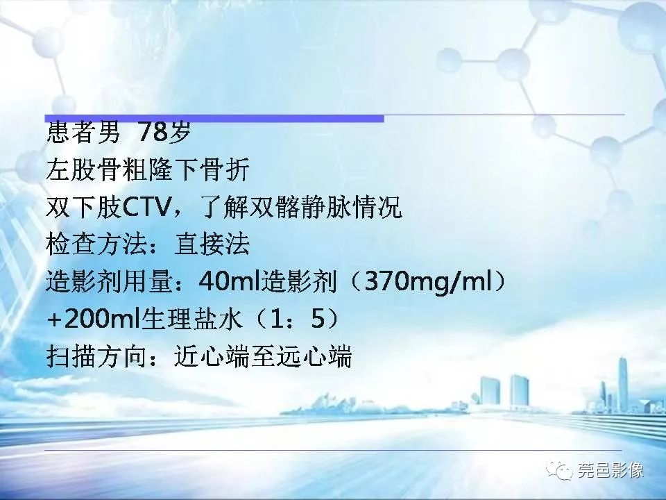 影像PPT - 【PPT】浅谈下肢静脉CTV的应用体会-15