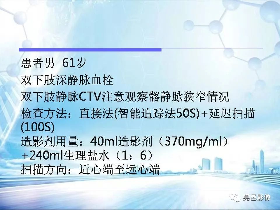 影像PPT - 【PPT】浅谈下肢静脉CTV的应用体会-25