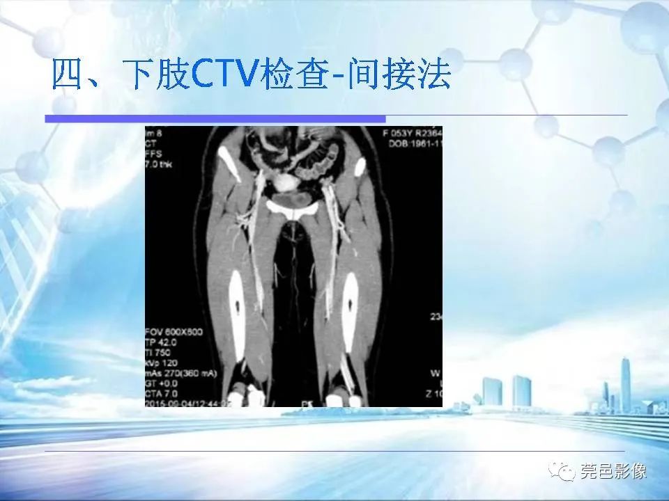 影像PPT - 【PPT】浅谈下肢静脉CTV的应用体会-34