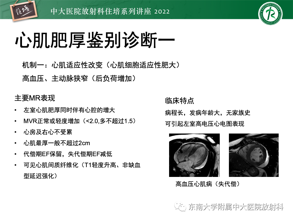 影像PPT - 【PPT】左心室肥厚的MR诊断及鉴别诊断思路-5