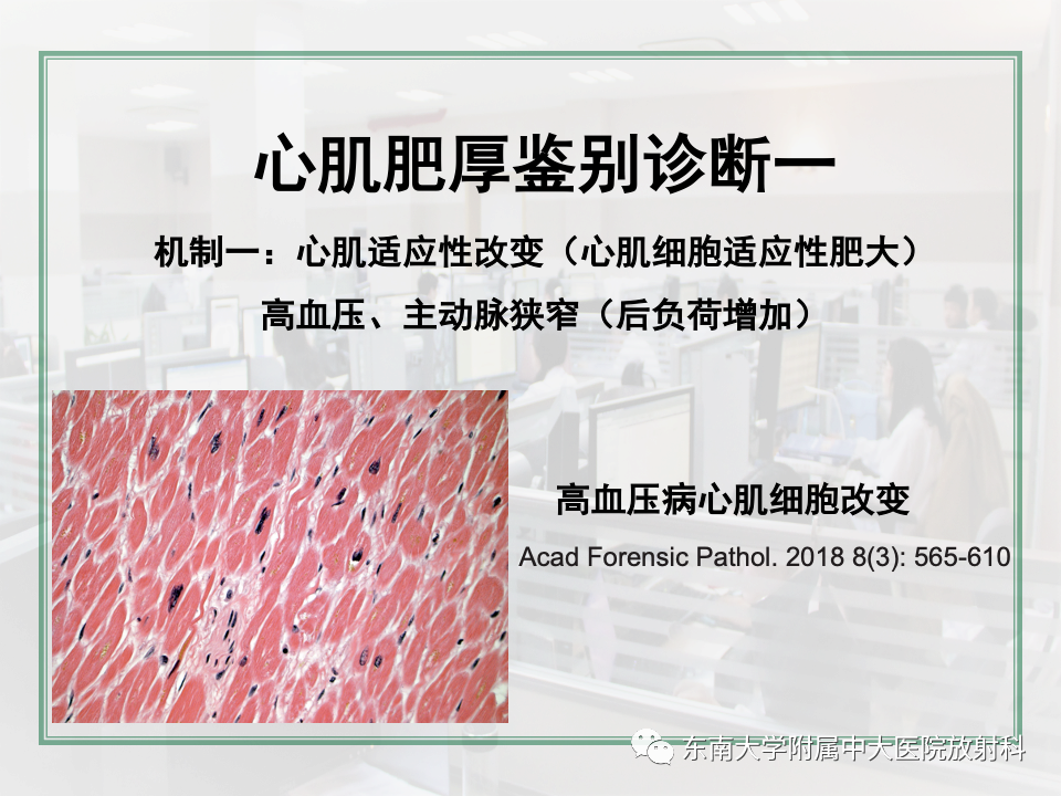 影像PPT - 【PPT】左心室肥厚的MR诊断及鉴别诊断思路-4