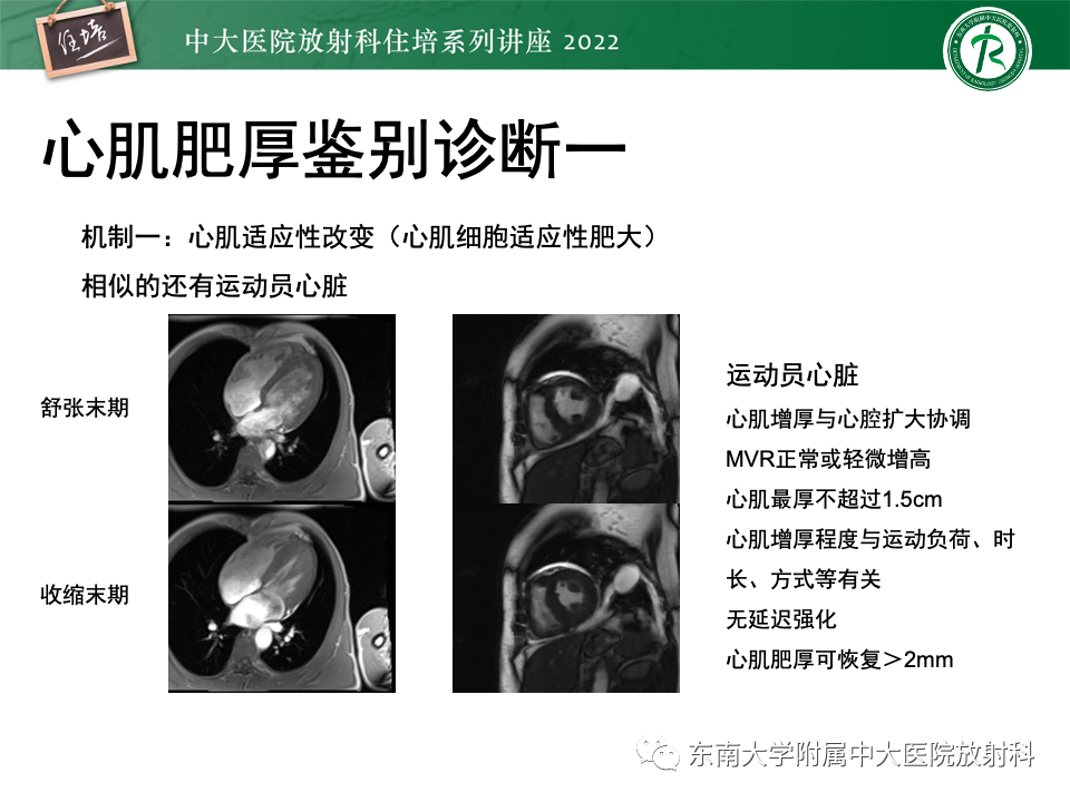 影像PPT - 【PPT】左心室肥厚的MR诊断及鉴别诊断思路-16