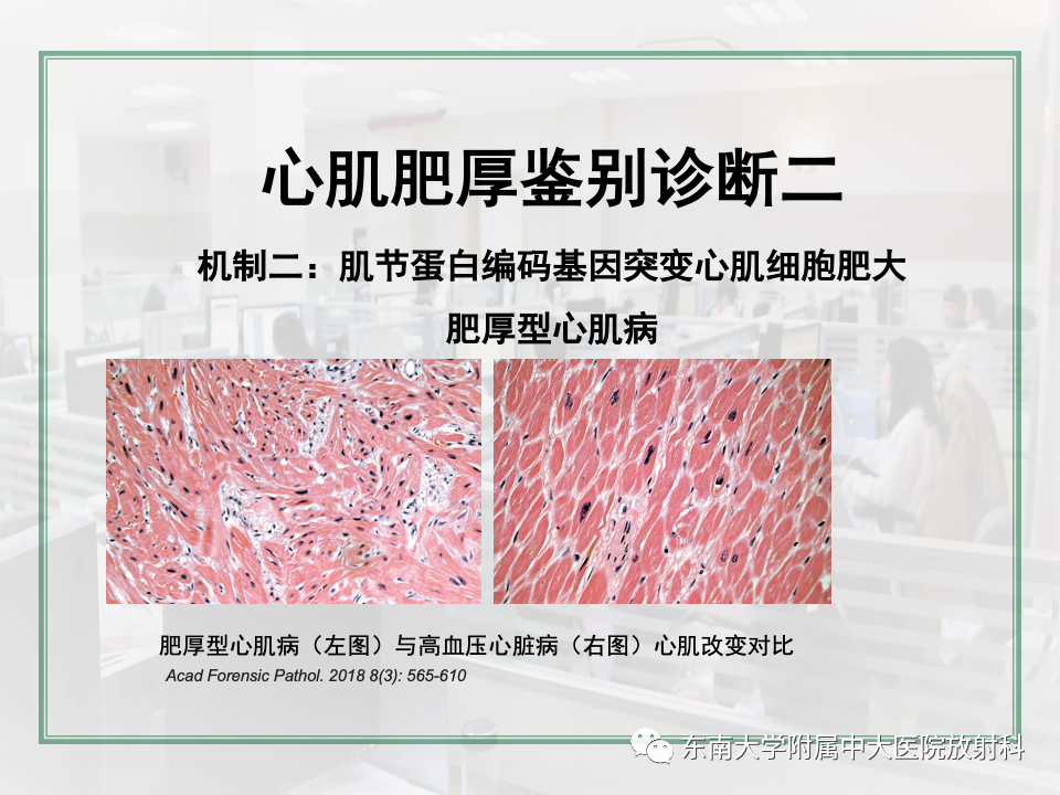 影像PPT - 【PPT】左心室肥厚的MR诊断及鉴别诊断思路-17
