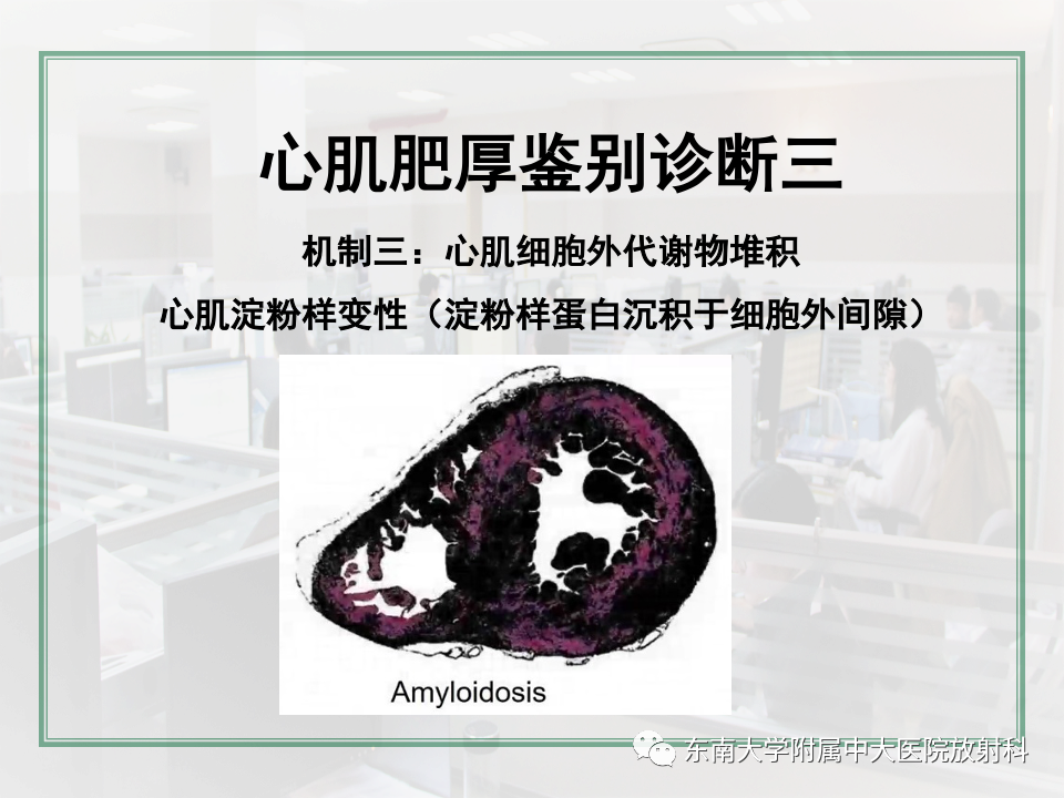 影像PPT - 【PPT】左心室肥厚的MR诊断及鉴别诊断思路-31