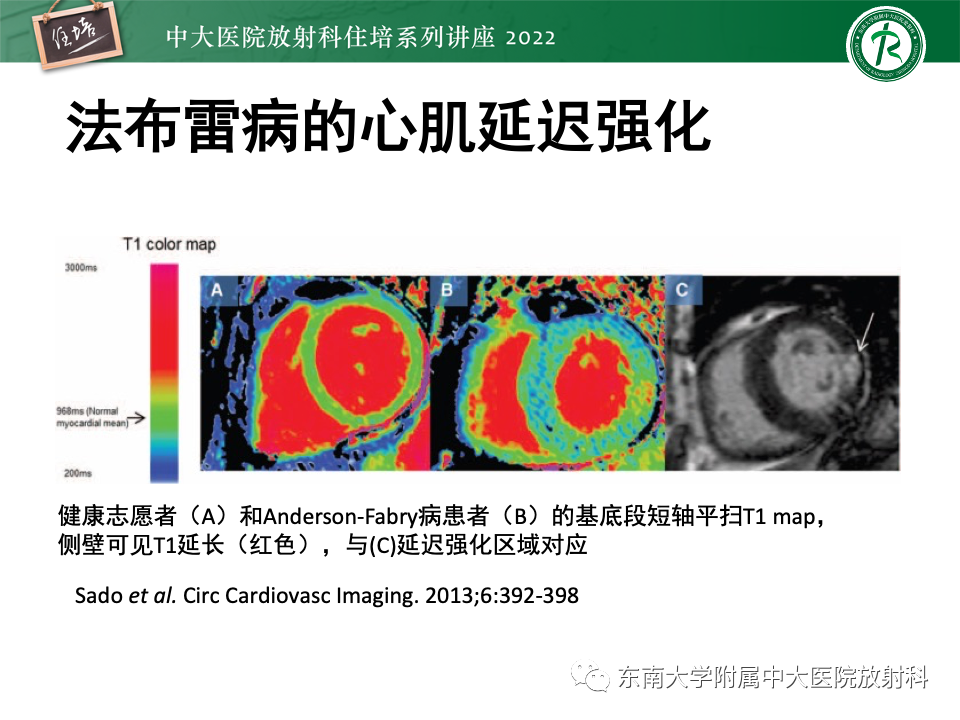 影像PPT - 【PPT】左心室肥厚的MR诊断及鉴别诊断思路-42
