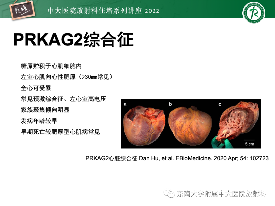 影像PPT - 【PPT】左心室肥厚的MR诊断及鉴别诊断思路-45