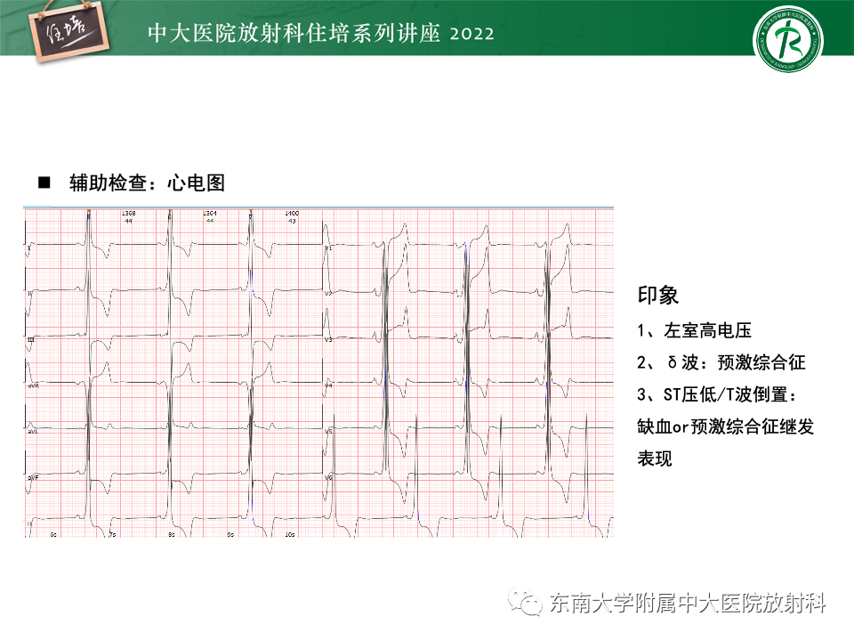 影像PPT - 【PPT】左心室肥厚的MR诊断及鉴别诊断思路-47
