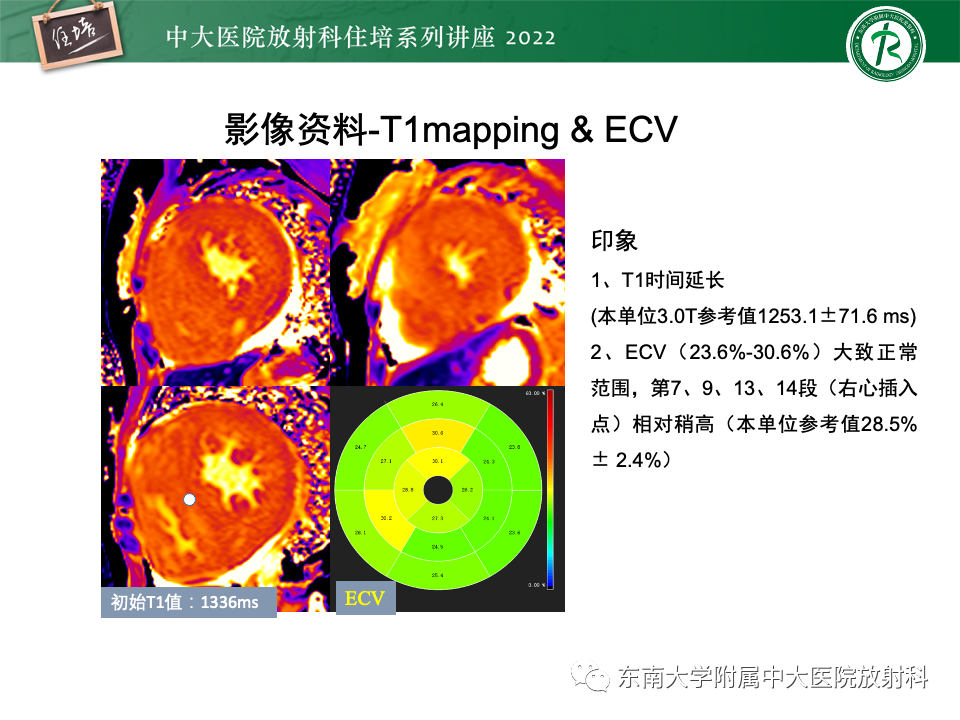 影像PPT - 【PPT】左心室肥厚的MR诊断及鉴别诊断思路-51