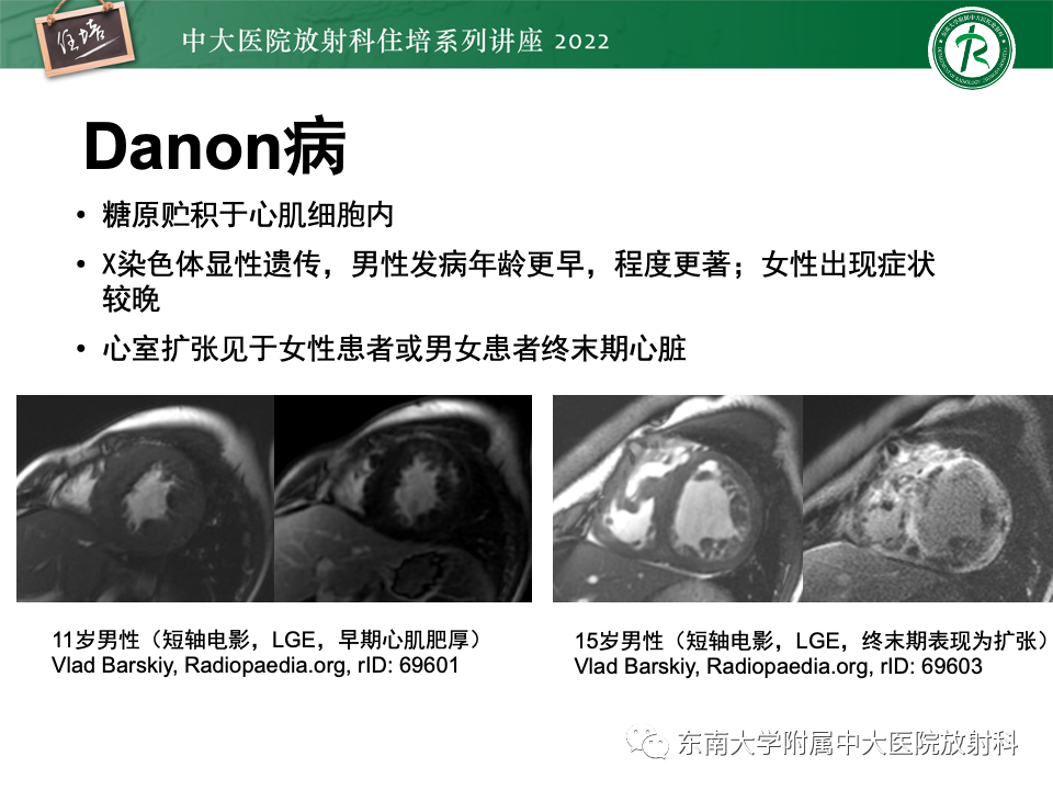 影像PPT - 【PPT】左心室肥厚的MR诊断及鉴别诊断思路-56
