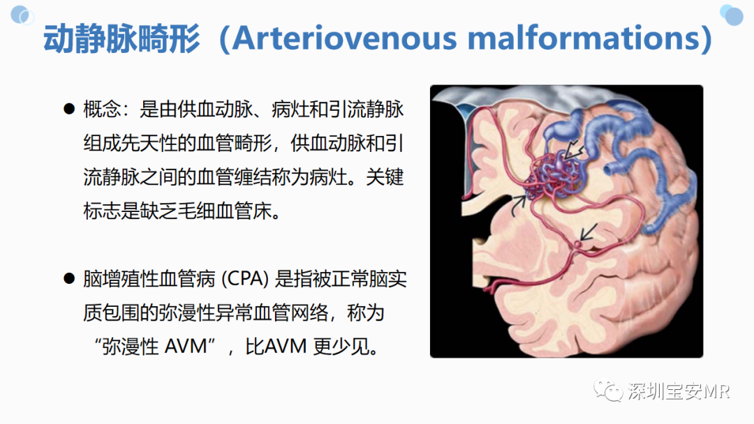 影像PPT - 【PPT】中枢神经系统血管畸形-6