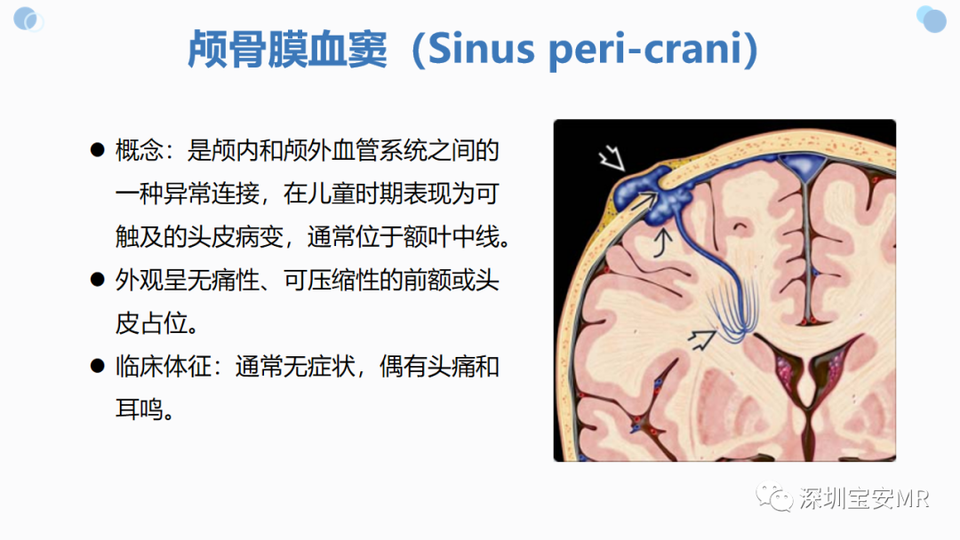 影像PPT - 【PPT】中枢神经系统血管畸形-30