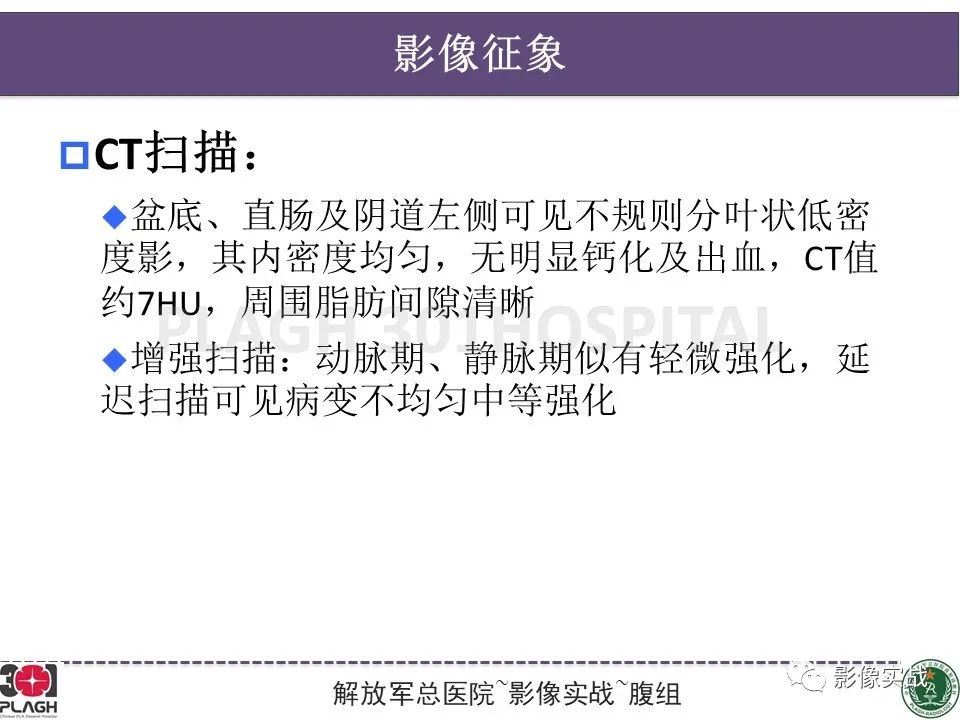 影像PPT - 【病例】侵袭性血管粘液瘤1例CT及MR-15