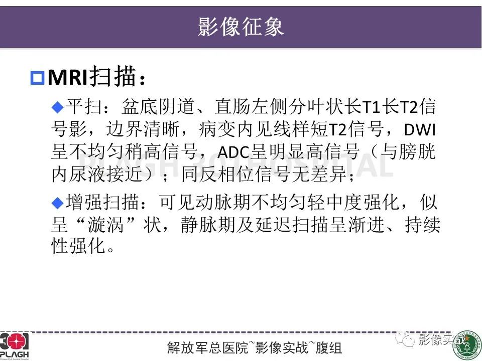 影像PPT - 【病例】侵袭性血管粘液瘤1例CT及MR-16