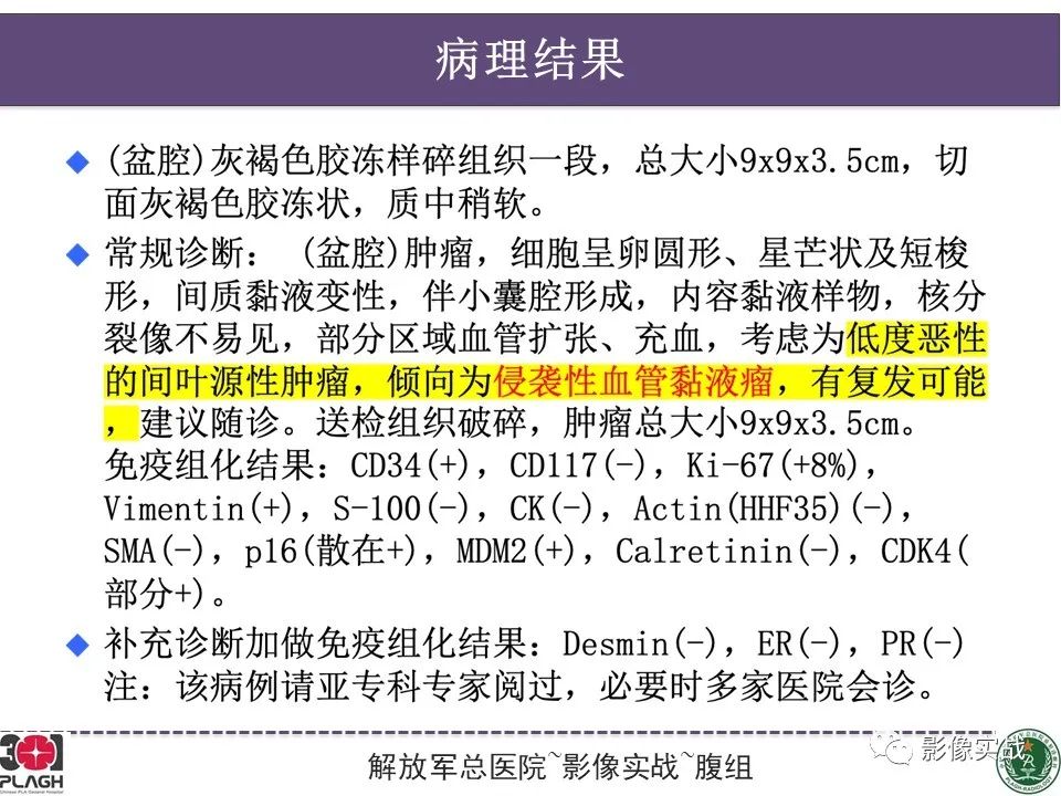 影像PPT - 【病例】侵袭性血管粘液瘤1例CT及MR-22