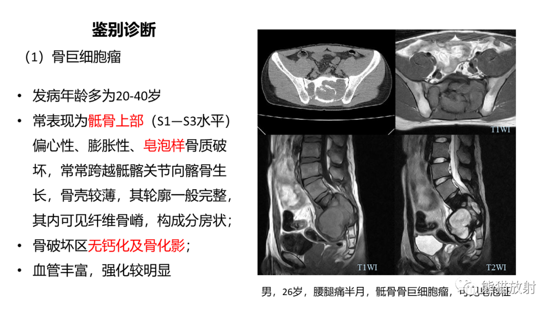 影像PPT - 【病例】斜坡 & 骶骨脊索瘤各1例CT及MR-17