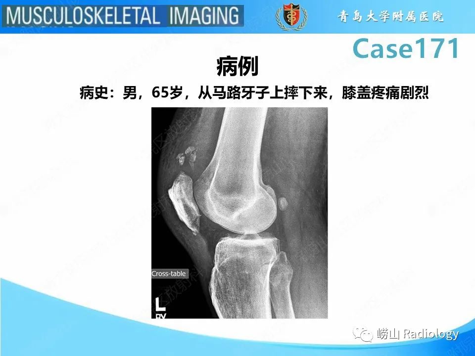 影像PPT - 【PPT】股四头肌肌腱断裂-2