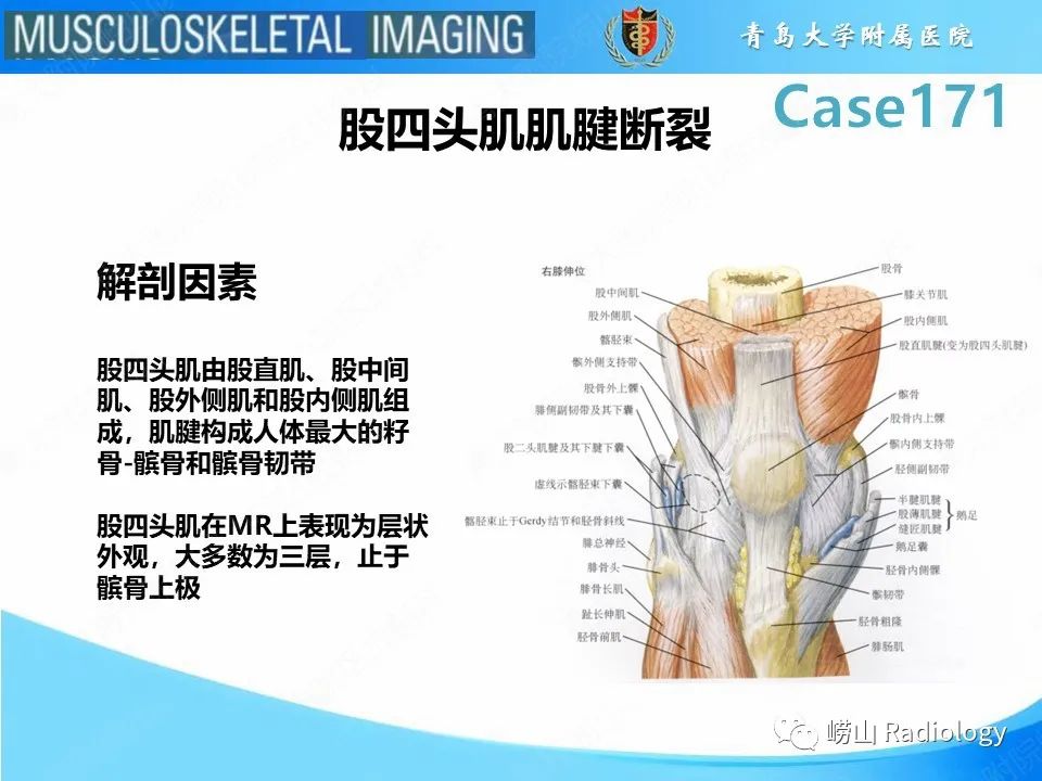 影像PPT - 【PPT】股四头肌肌腱断裂-5