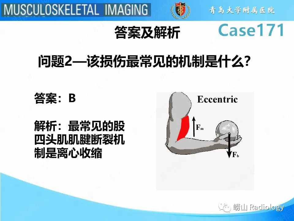 影像PPT - 【PPT】股四头肌肌腱断裂-7