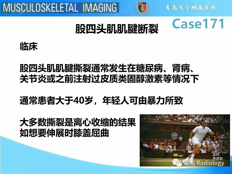 影像PPT - 【PPT】股四头肌肌腱断裂-13