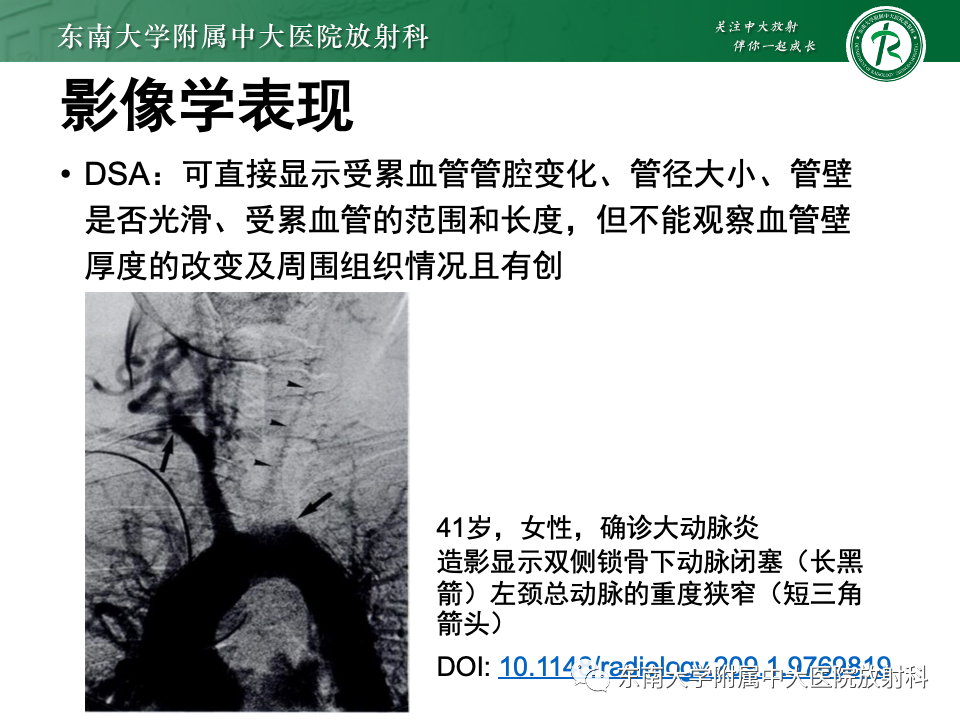 影像PPT - 【PPT】多发性大动脉炎-24