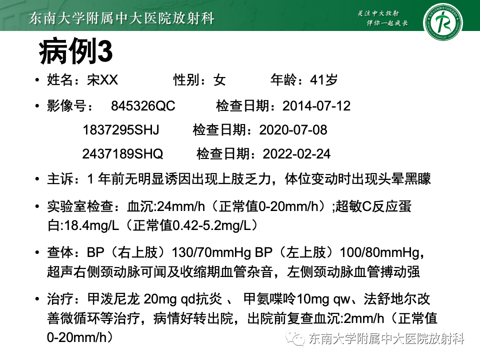 影像PPT - 【PPT】多发性大动脉炎-28