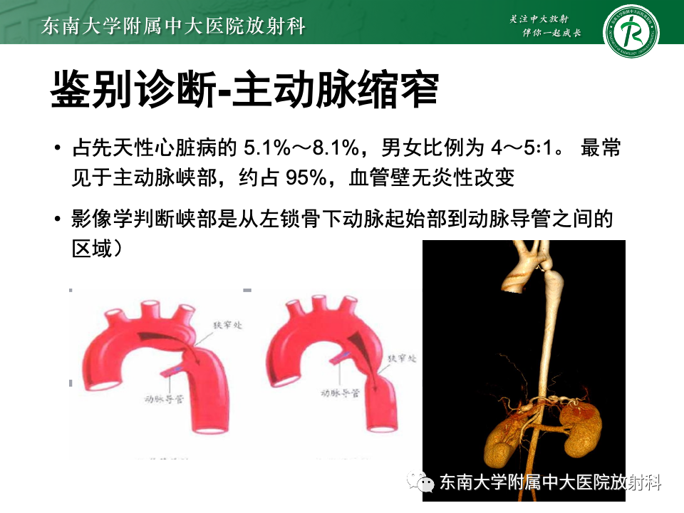 影像PPT - 【PPT】多发性大动脉炎-31