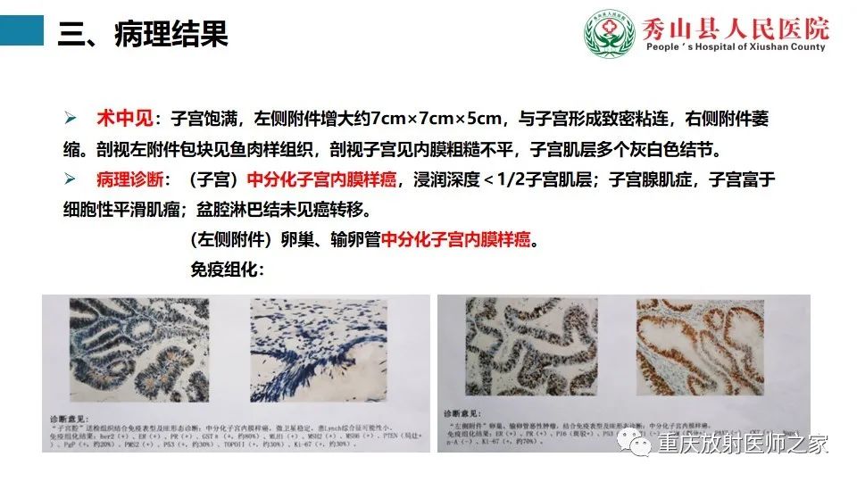 影像PPT - 【病例】子宫内膜样癌1例MR影像-7