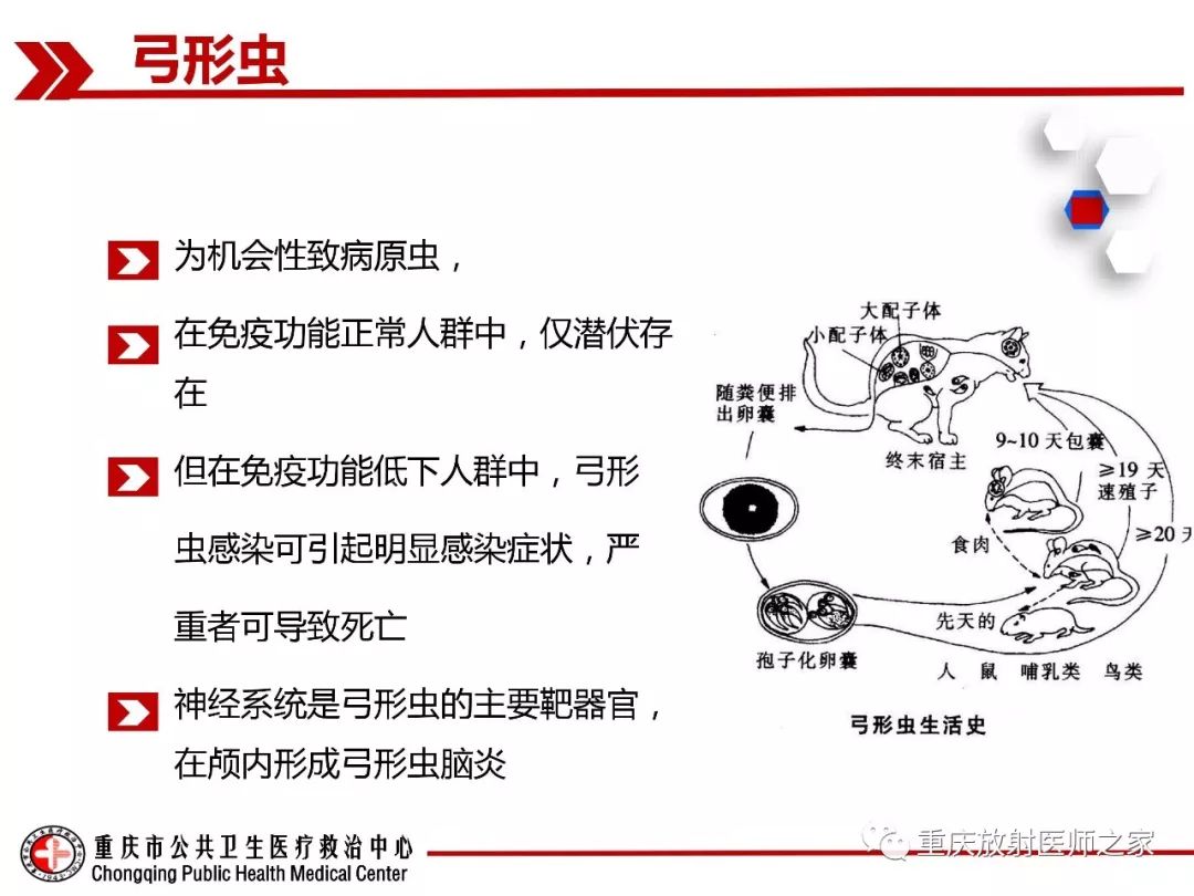 影像PPT - 【PPT】艾滋病相关弓形虫脑炎的影像表现-2