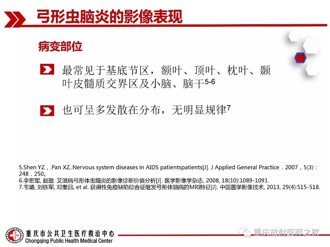 影像PPT - 【PPT】艾滋病相关弓形虫脑炎的影像表现-7