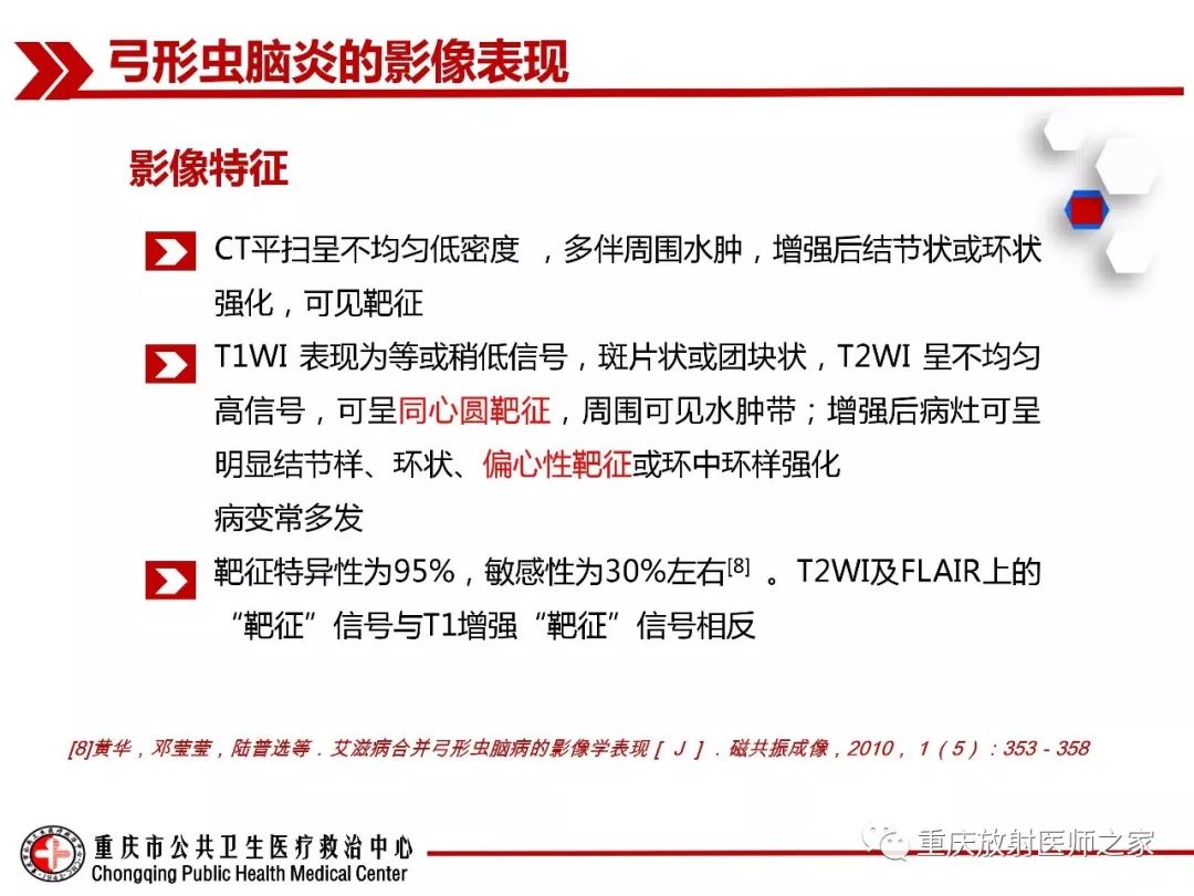 影像PPT - 【PPT】艾滋病相关弓形虫脑炎的影像表现-8