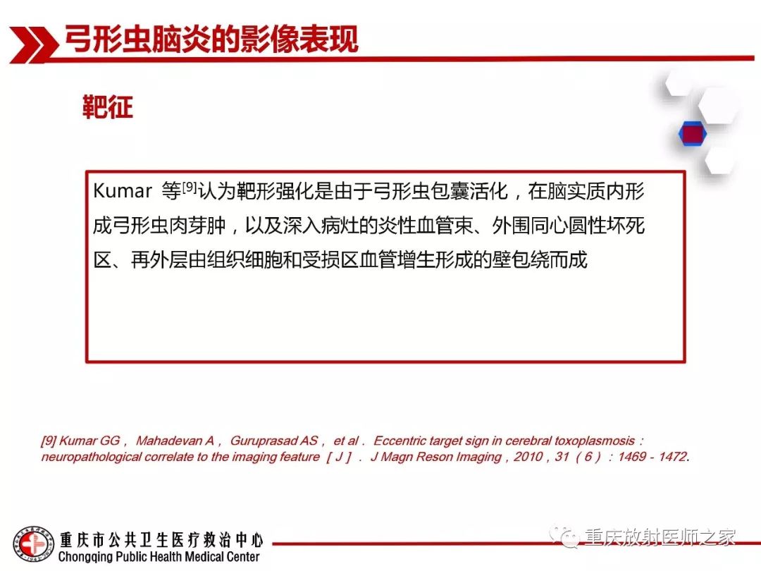 影像PPT - 【PPT】艾滋病相关弓形虫脑炎的影像表现-10