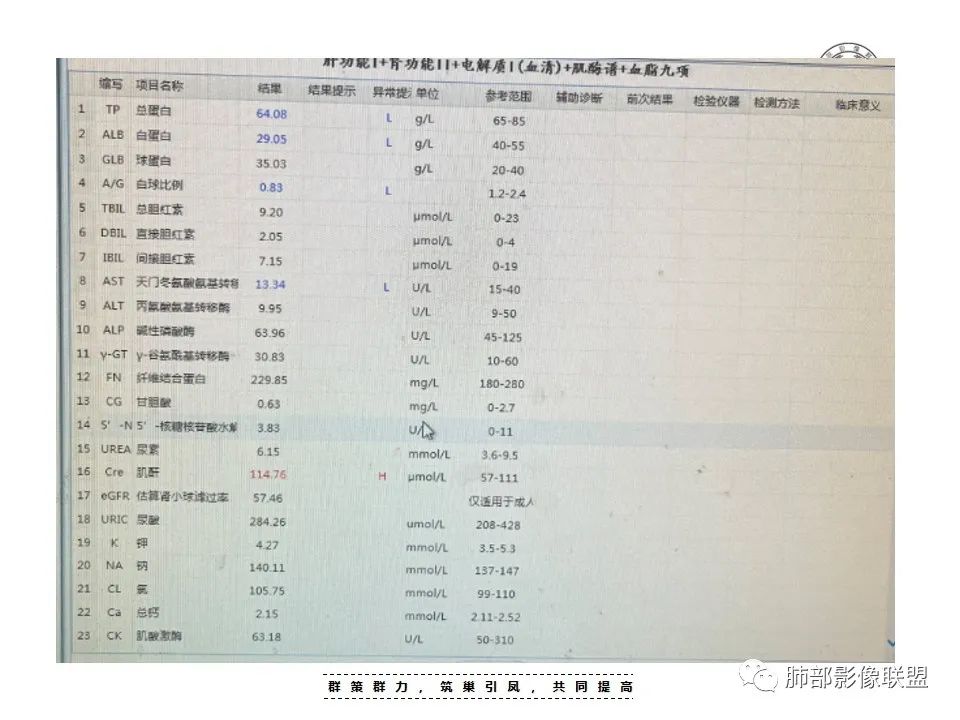 影像PPT - 【病例】恶性胸膜间皮瘤1例CT-5 影像PPT - 【病例】恶性胸膜间皮瘤1例CT-5