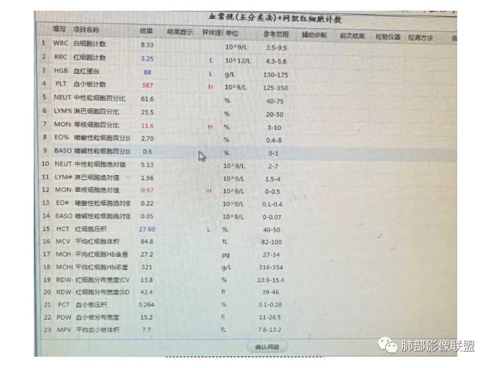 影像PPT - 【病例】恶性胸膜间皮瘤1例CT-4 影像PPT - 【病例】恶性胸膜间皮瘤1例CT-4