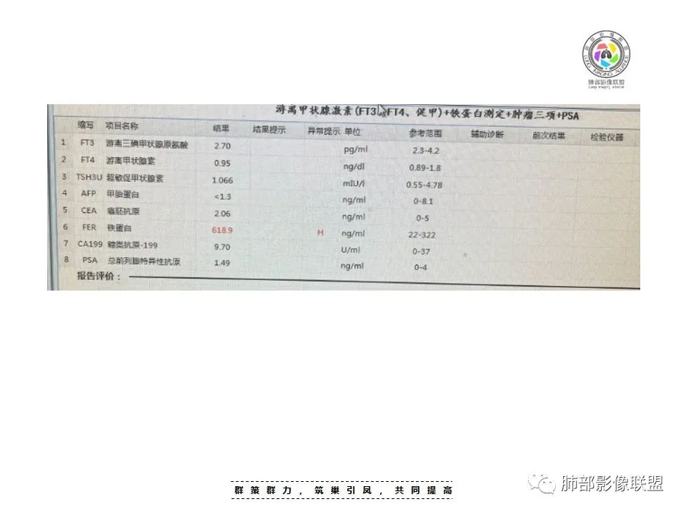 影像PPT - 【病例】恶性胸膜间皮瘤1例CT-3 影像PPT - 【病例】恶性胸膜间皮瘤1例CT-3