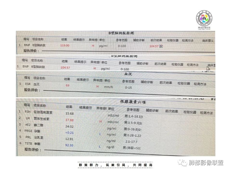 影像PPT - 【病例】恶性胸膜间皮瘤1例CT-6 影像PPT - 【病例】恶性胸膜间皮瘤1例CT-6