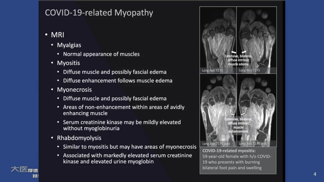 影像PPT - 【PPT】COVID-19 的肌肉骨骼表现：对目前所描述的多模态成像及临床症状的图片综述​-2