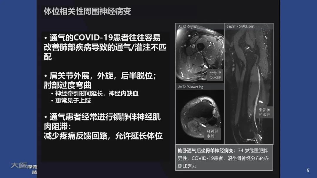影像PPT - 【PPT】COVID-19 的肌肉骨骼表现：对目前所描述的多模态成像及临床症状的图片综述​-7