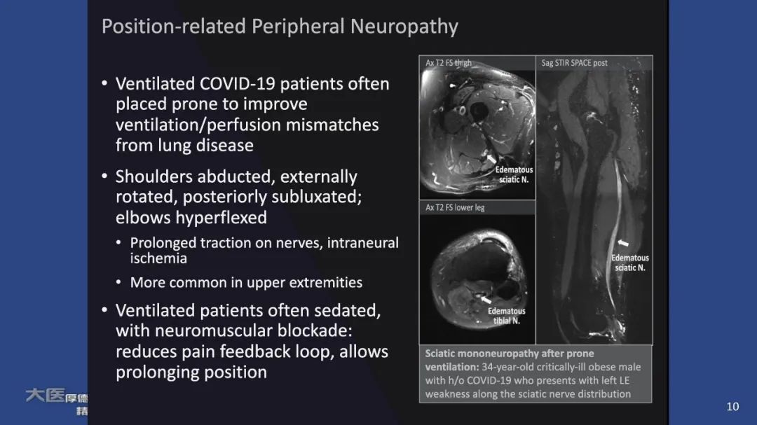影像PPT - 【PPT】COVID-19 的肌肉骨骼表现：对目前所描述的多模态成像及临床症状的图片综述​-8