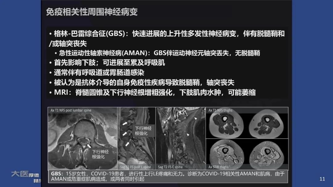 影像PPT - 【PPT】COVID-19 的肌肉骨骼表现：对目前所描述的多模态成像及临床症状的图片综述​-9