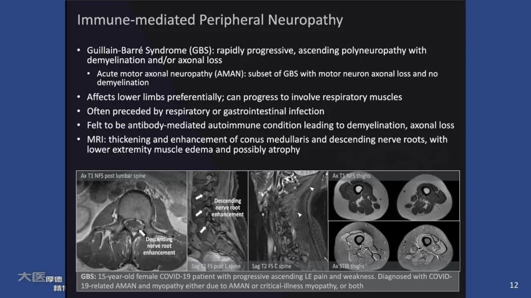 影像PPT - 【PPT】COVID-19 的肌肉骨骼表现：对目前所描述的多模态成像及临床症状的图片综述​-10