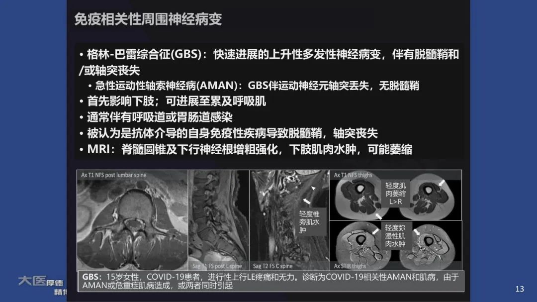 影像PPT - 【PPT】COVID-19 的肌肉骨骼表现：对目前所描述的多模态成像及临床症状的图片综述​-11