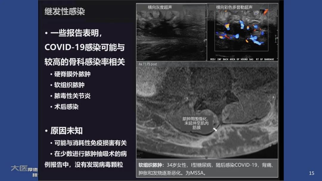 影像PPT - 【PPT】COVID-19 的肌肉骨骼表现：对目前所描述的多模态成像及临床症状的图片综述​-13