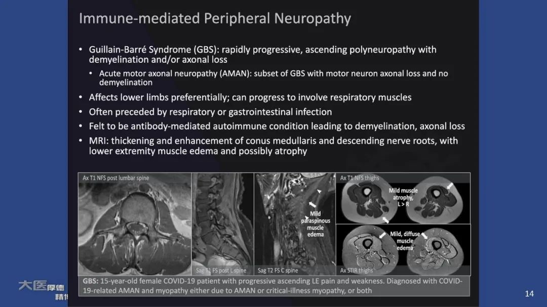 影像PPT - 【PPT】COVID-19 的肌肉骨骼表现：对目前所描述的多模态成像及临床症状的图片综述​-12