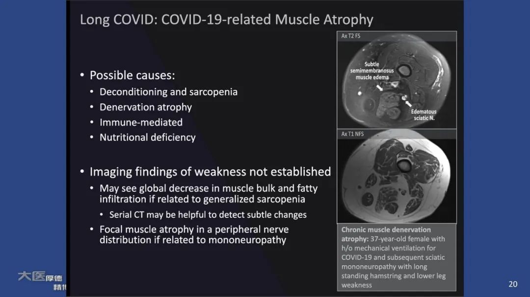 影像PPT - 【PPT】COVID-19 的肌肉骨骼表现：对目前所描述的多模态成像及临床症状的图片综述​-18