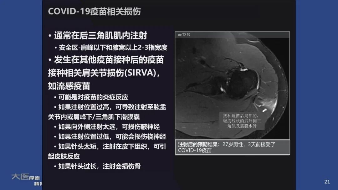 影像PPT - 【PPT】COVID-19 的肌肉骨骼表现：对目前所描述的多模态成像及临床症状的图片综述​-19