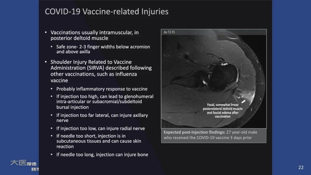 影像PPT - 【PPT】COVID-19 的肌肉骨骼表现：对目前所描述的多模态成像及临床症状的图片综述​-20