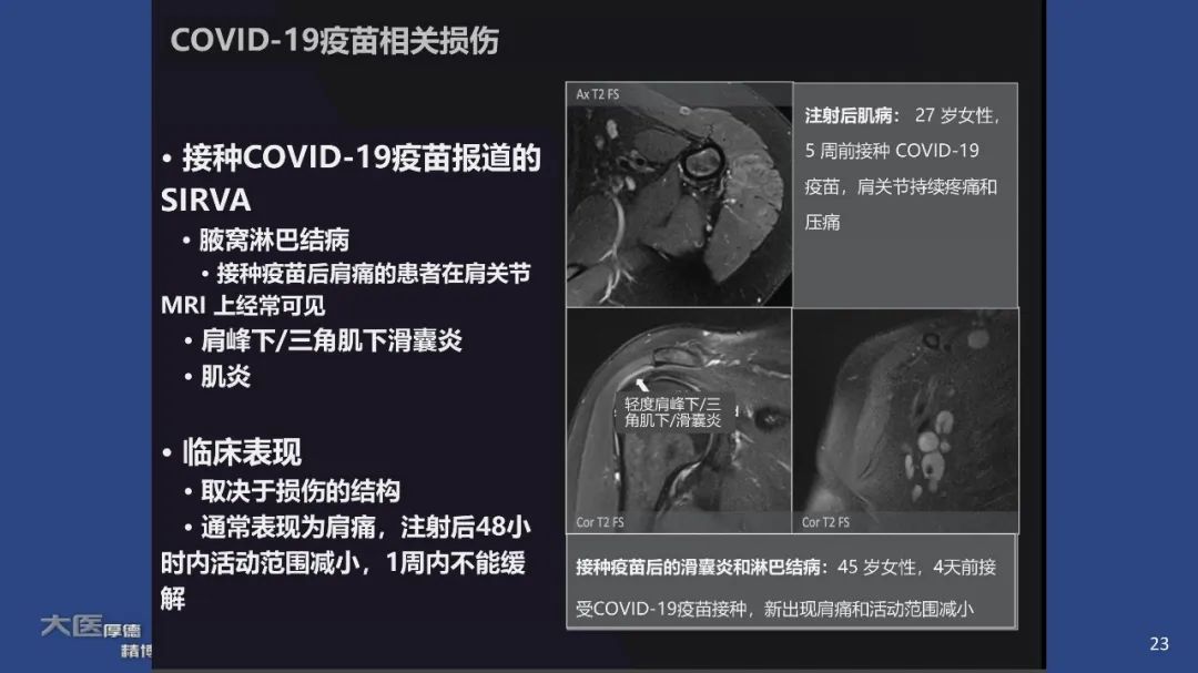 影像PPT - 【PPT】COVID-19 的肌肉骨骼表现：对目前所描述的多模态成像及临床症状的图片综述​-21